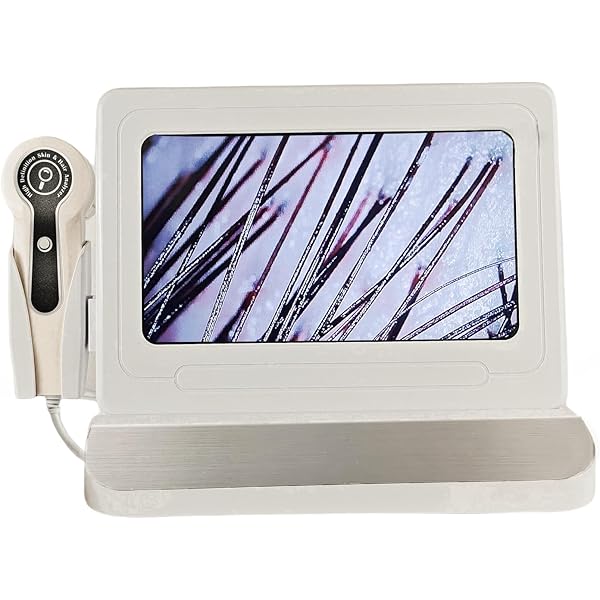 Professional Scalp Camera with 11-Inch HD Screen - High-Definition Hair & Scalp Analysis Device for Salons and Spas, Easy to Use with Memory Storage, Ideal for Scalp Treatments & Client Consultations